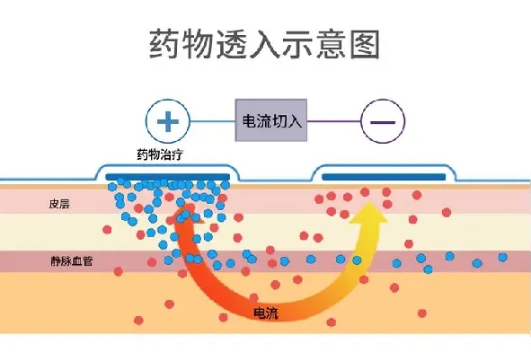 中醫(yī)定向透藥療法助力重癥患者恢復(fù)健康